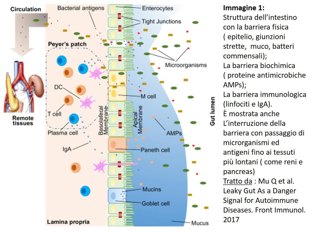 sindrome intestino bucato