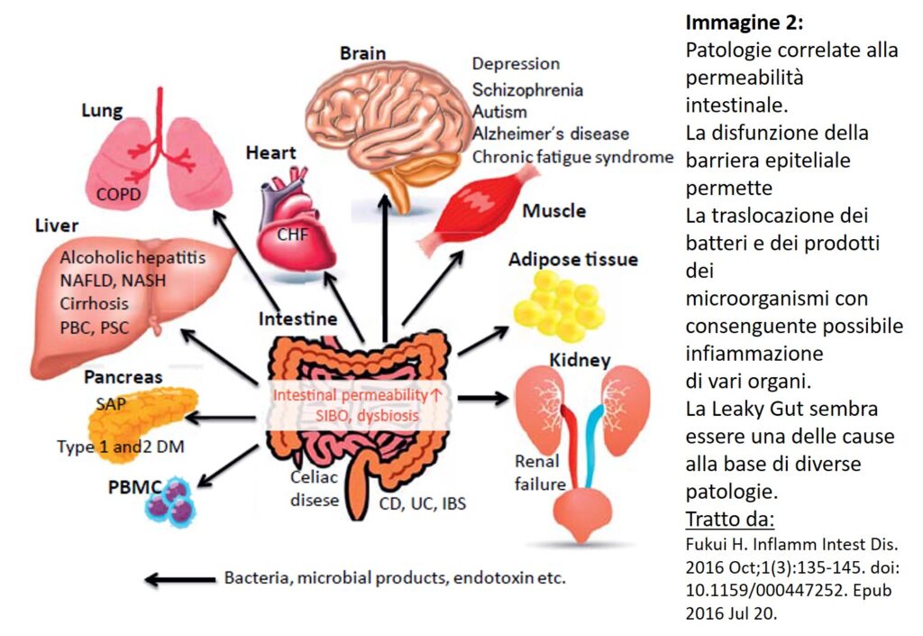 patologie intestino